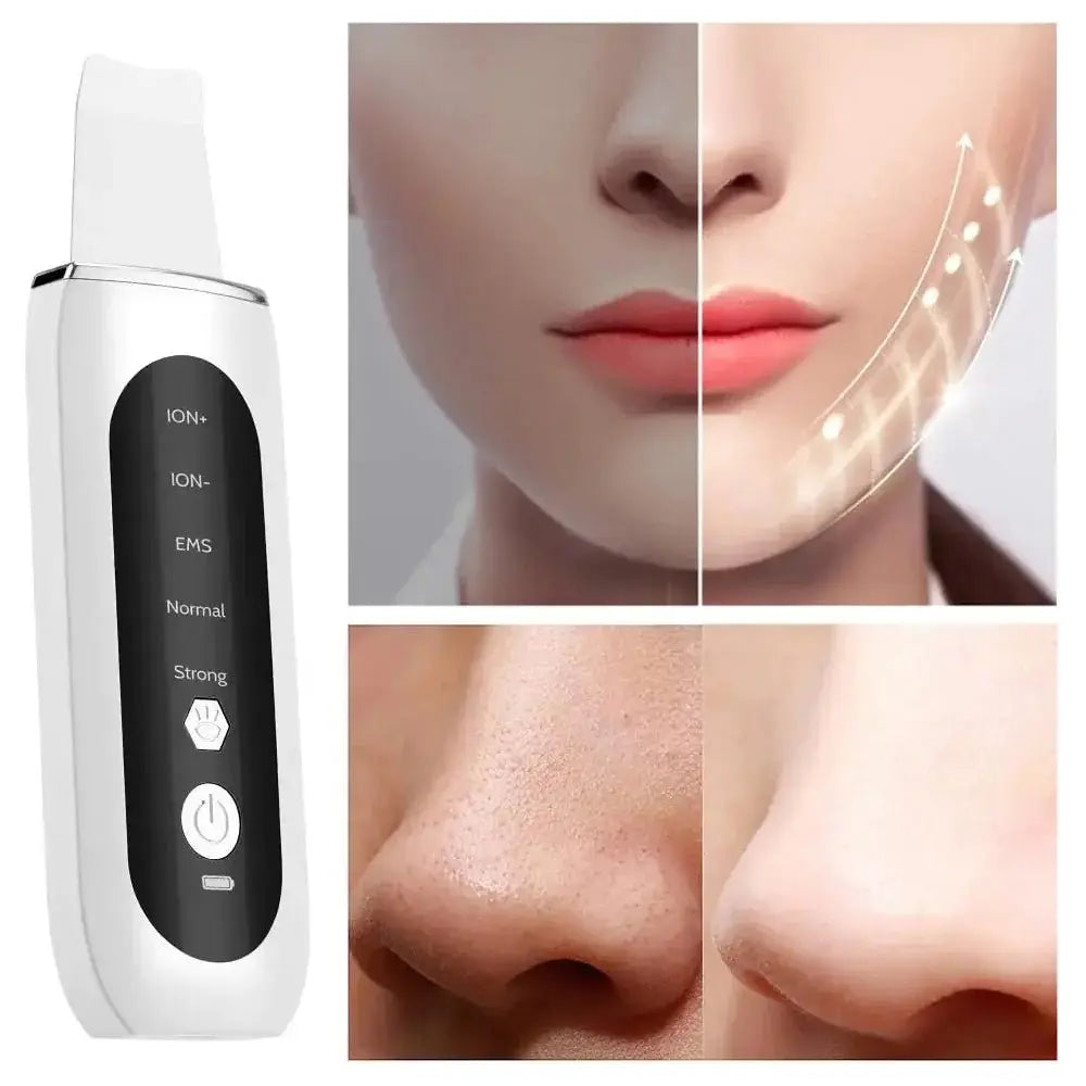 Ultrasonic Face Skin Scrubber - Glam Global UK