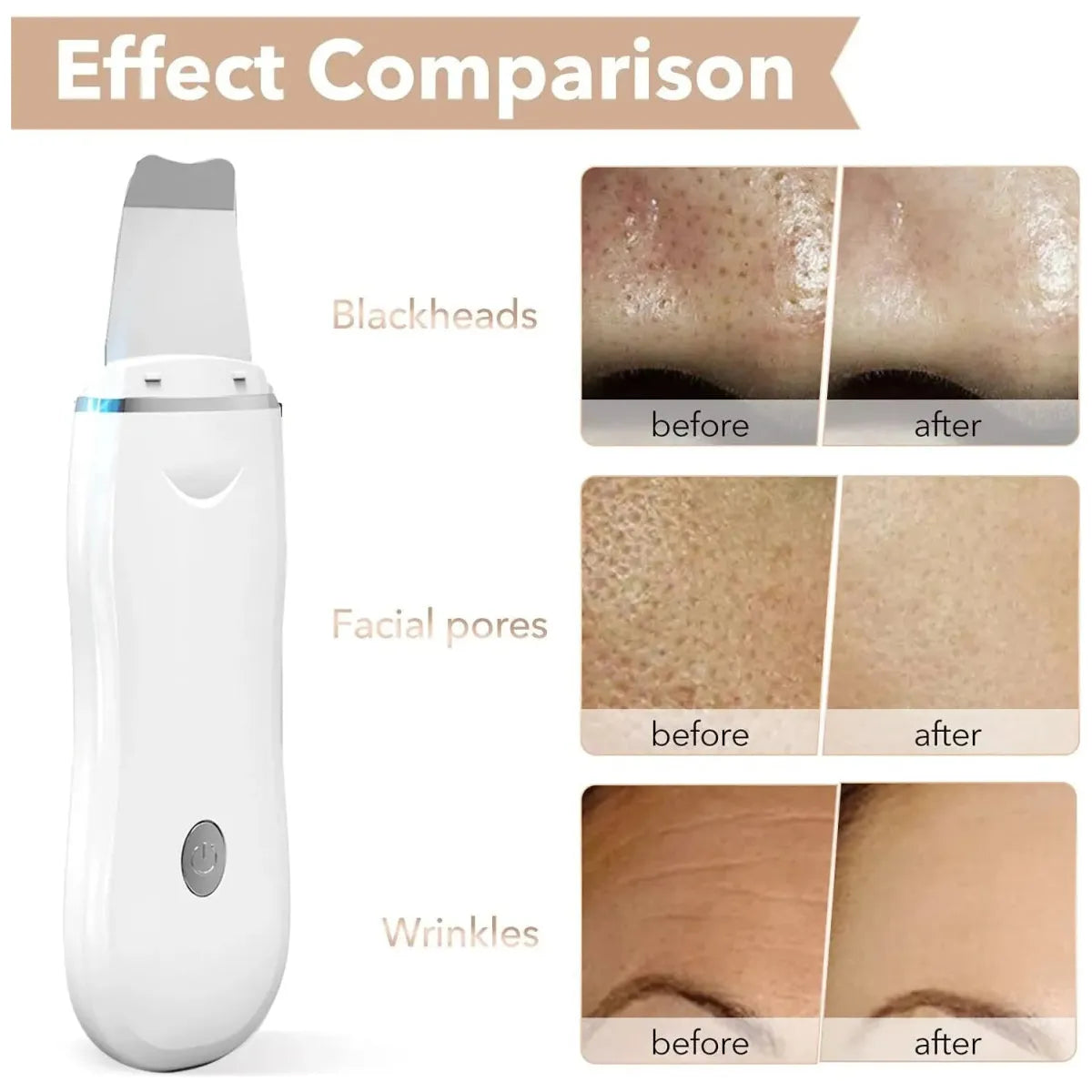 Ultrasonic Skin Scrubber - Glam Global UK