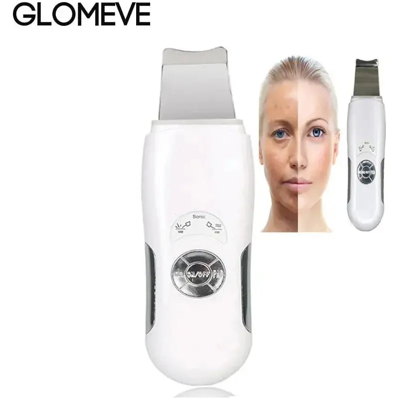 Ultrasonic Skin Scrubber Facial Cleanser - Glam Global UK