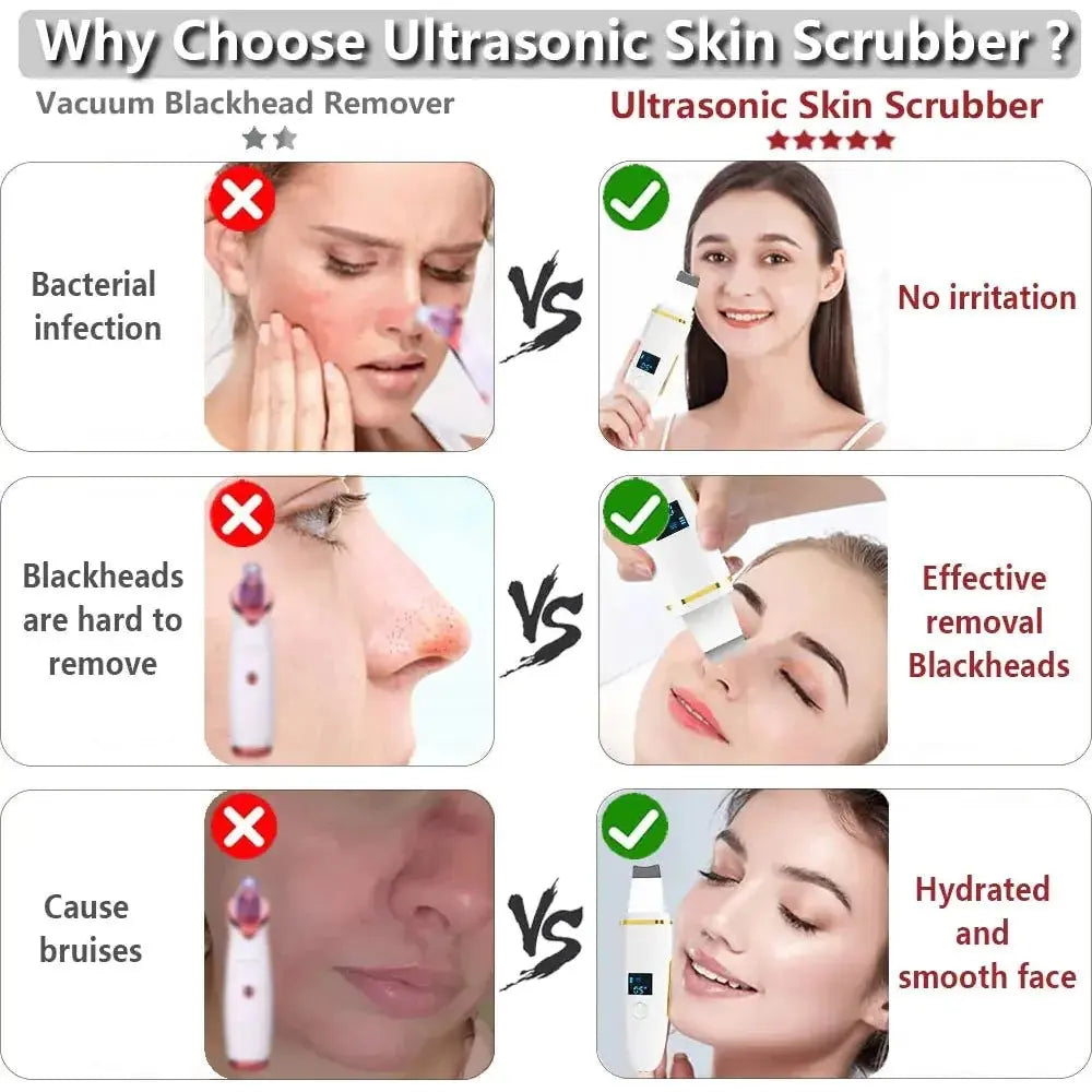 Ultrasonic Skin Scrubber: Professional Facial Cleansing Device - Glam Global UK