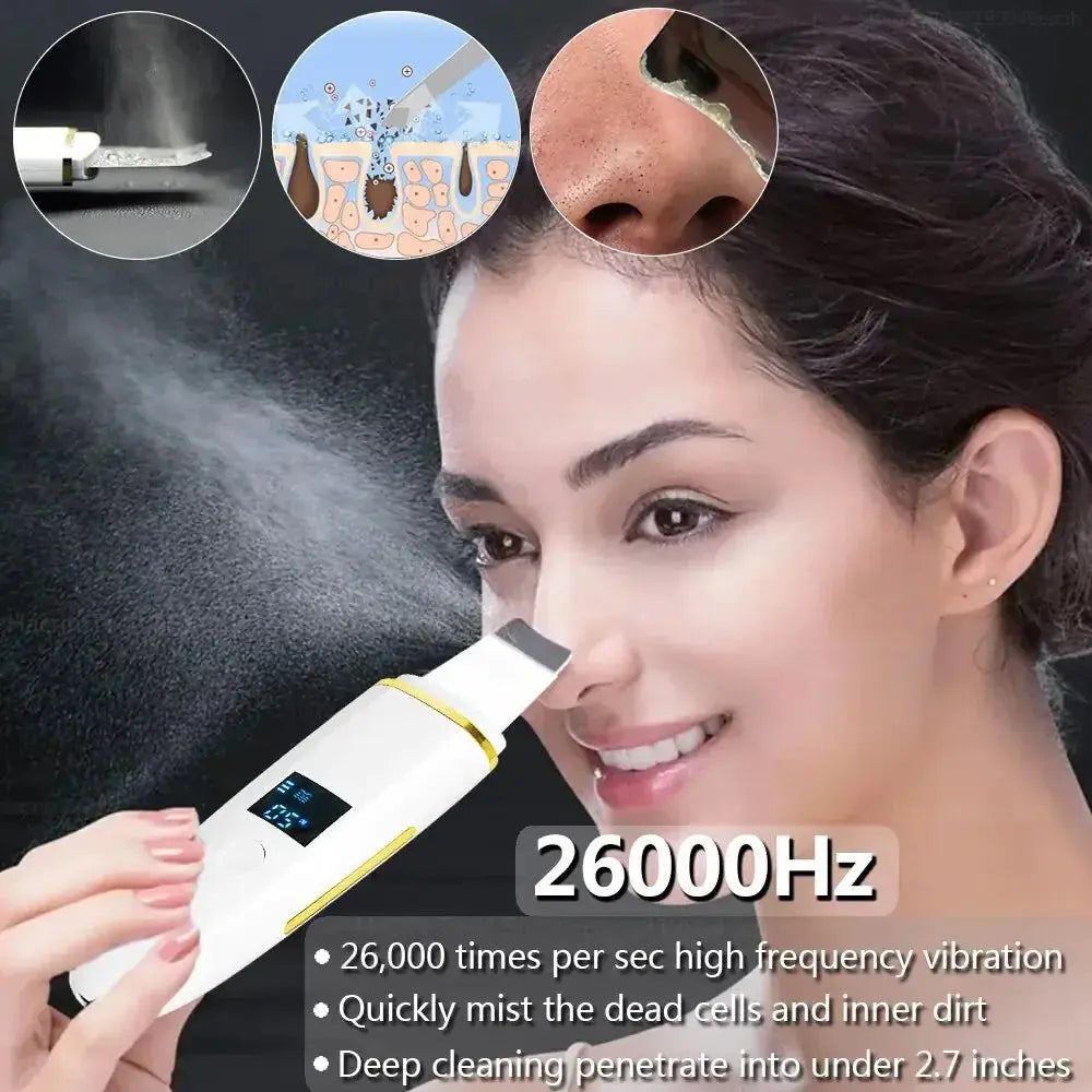 Ultrasonic Skin Scrubber: Professional Facial Cleansing Device - Glam Global UK