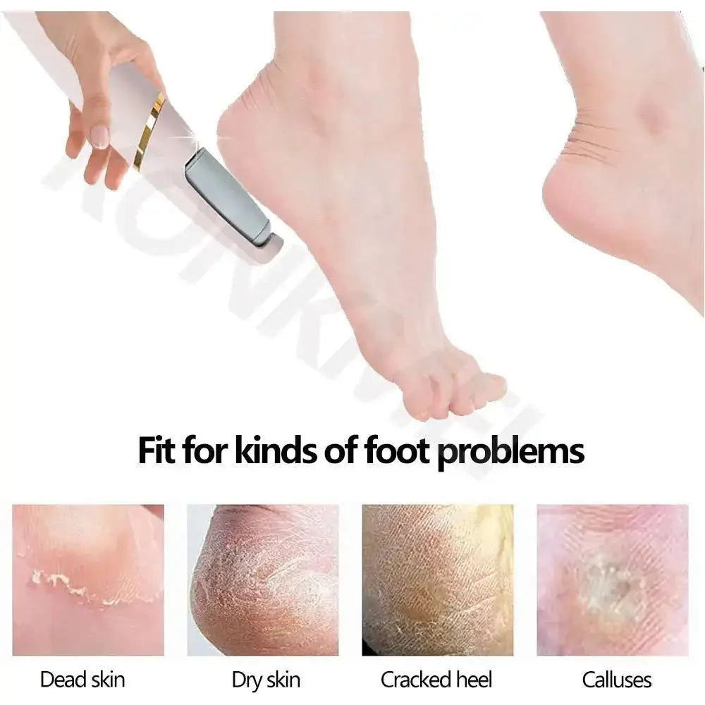 VelvetStep Foot Exfoliator - Glam Global UK