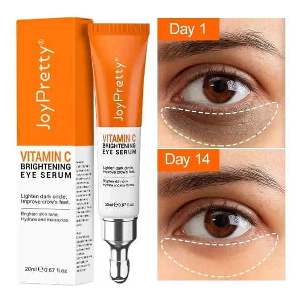 Joy Pretty Vitamin C Brightening Eye Cream – Anti - Dark Circles, Eye Bag & Puffiness Solution - Glam Global UKJoy Pretty