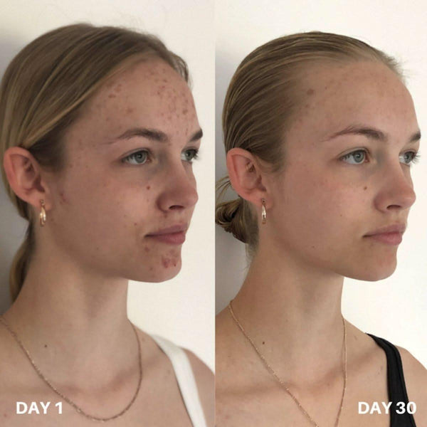 Clinisoothe+ | Skin Purifier | 250ml - Glam Global UKClinisoothe+