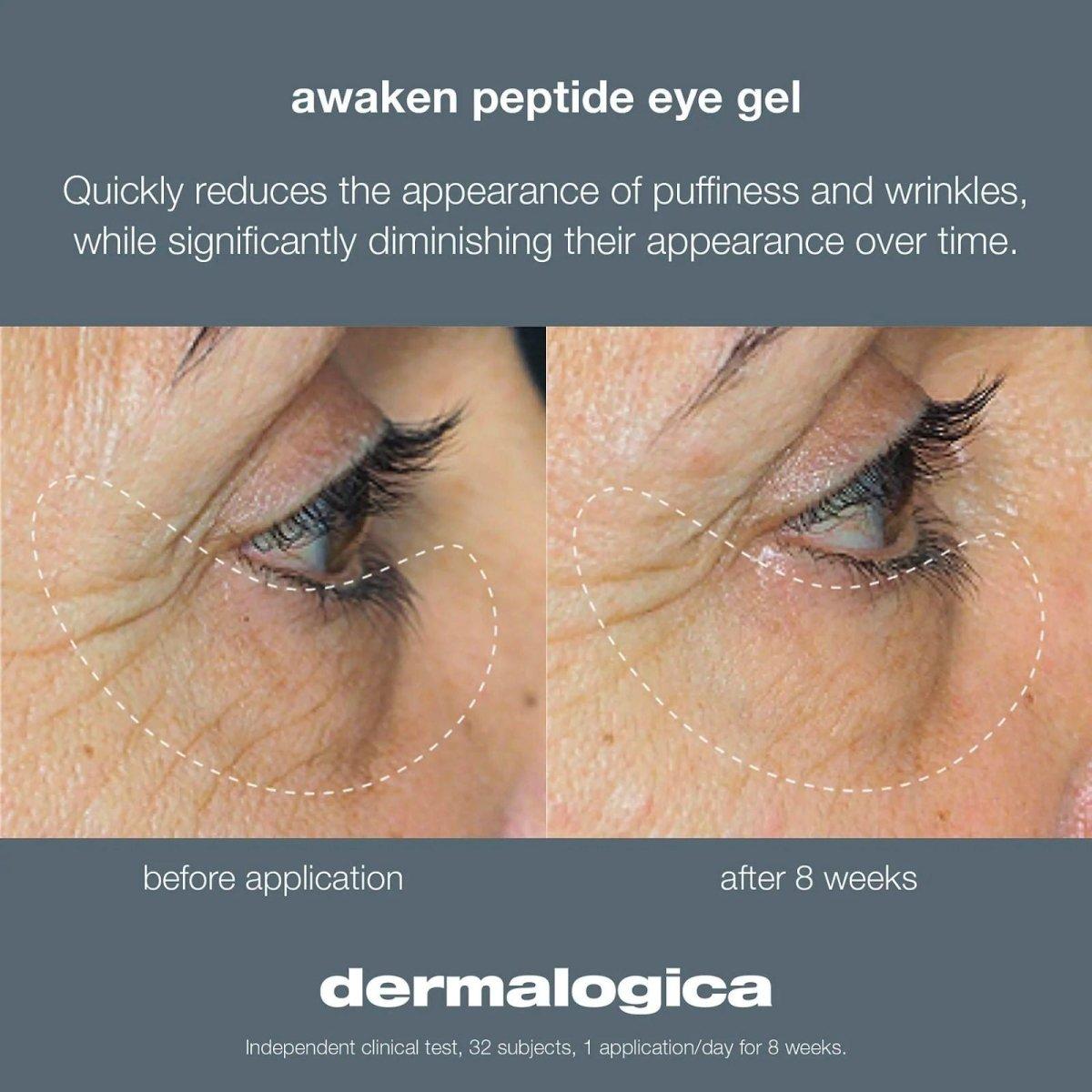 Dermalogica | Awaken Peptide Eye Gel | 15ml - DG International Ventures Limited