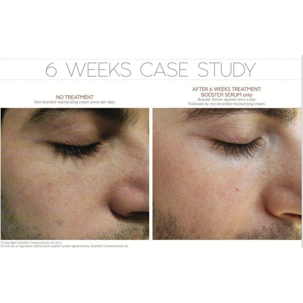 Dr LEVY Switzerland | Booster Serum - Glam Global UKDr Levy Switzerland