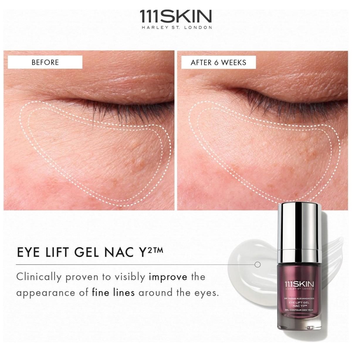 Eye Lift Gel NAC Y2 - Glam Global UK