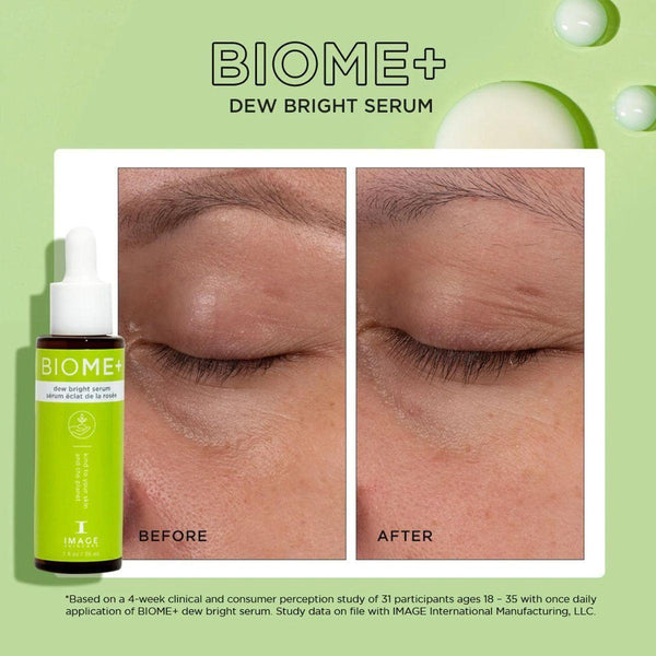 Image Skincare BIOME+ Dew Bright Serum - 30ml - Glam Global UKImage Skincare
