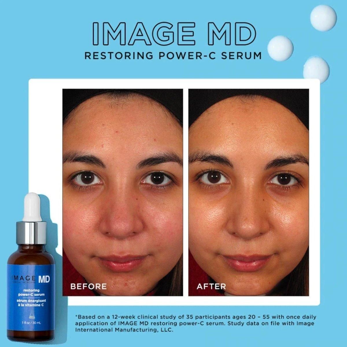 Image Skincare | MD Restoring Power-C Serum | 30ml - DG International Ventures Limited