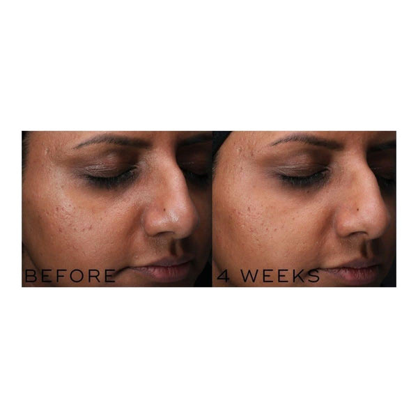 Medik8 Clarity Peptides - 30ml - Glam Global UKMedik8