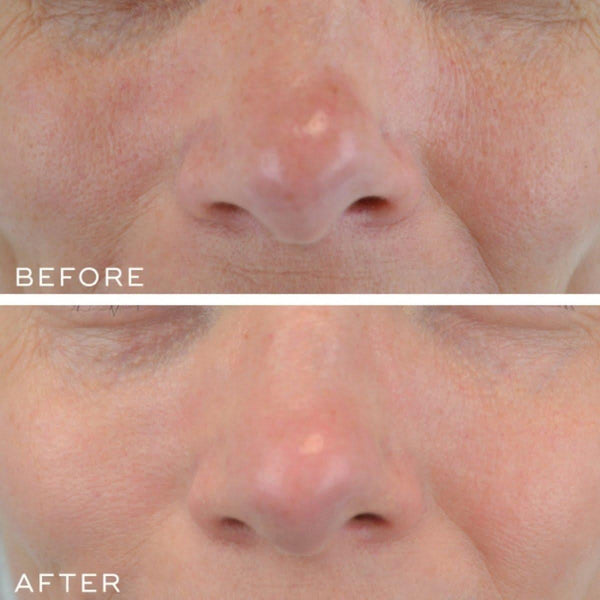 Medik8 Crystal Retinal 10 - 30ml - Glam Global UKMedik8