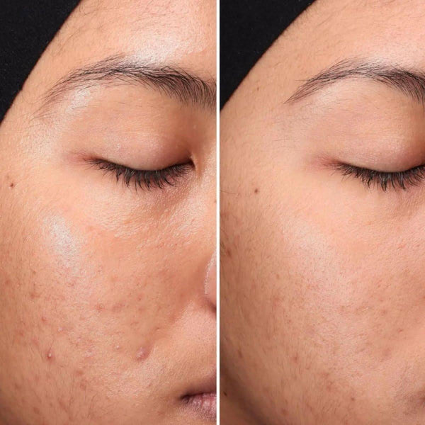 Medik8 Press & Clear 150ml - Glam Global UKMedik8