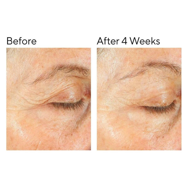 Murad Intense Recovery Cream - 50ml - Glam Global UKMurad