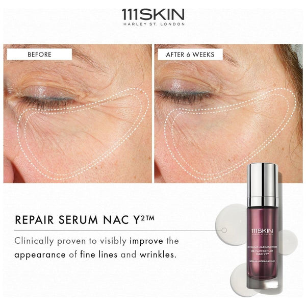 111SKIN Repair Serum NAC Y2 - 30ml - Glam Global UK111SKIN