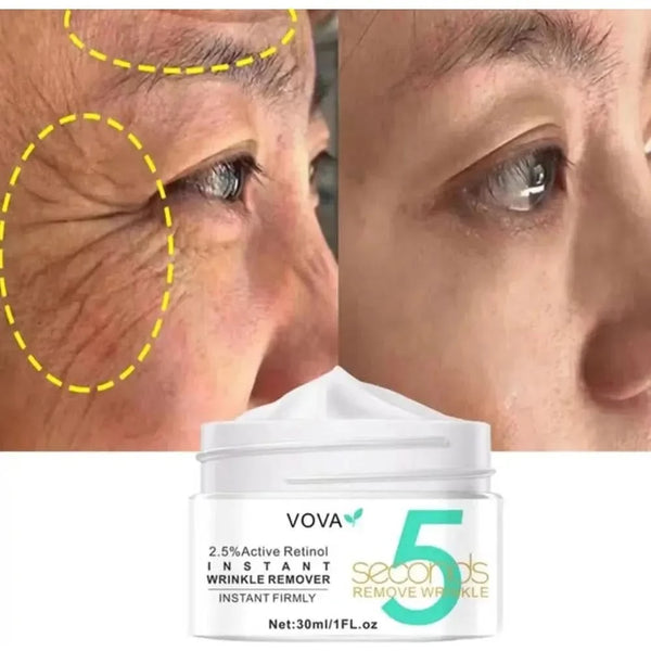 Vova Active Retinol Cream - 30ml - Glam Global UKVova