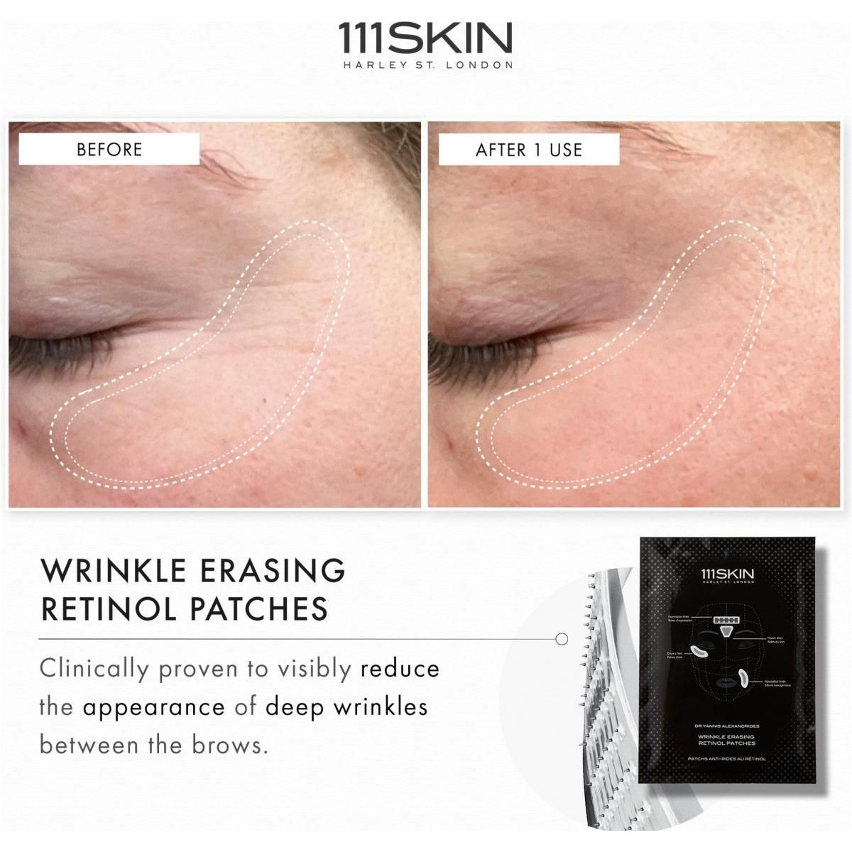 Wrinkle Erasing Retinol Patches - Glam Global UK