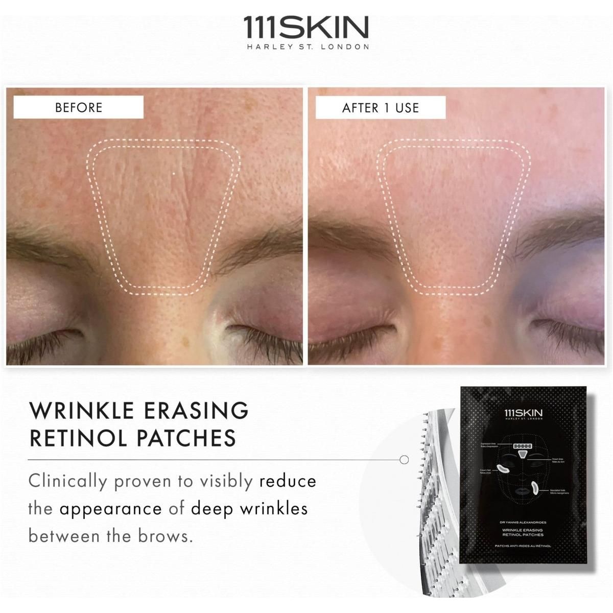 Wrinkle Erasing Retinol Patches - Glam Global UK